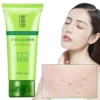 Face Exfoliating Gel Aloe Vera Remove Blackhead Moisturizing Shrink Pores Skin Care 30g-100g