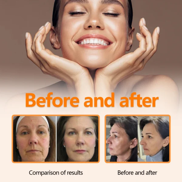 vitamin c facial serum reduces fine lines and brightens skin naturally without added retinol, jojoba oil facial care products vitamin c facial serum reduces fine lines and brightens skin naturally without added retinol, jojoba oil facial care products